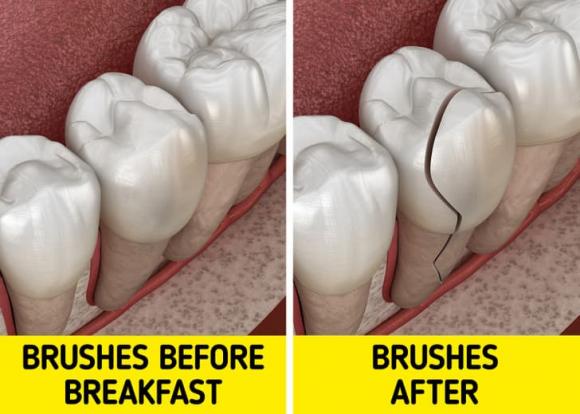 đánh răng, đánh răng sau khi ăn sáng, sức khỏe 