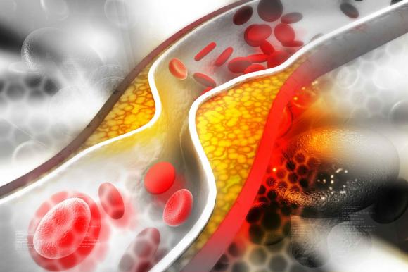 trứng, ăn trứng, chế độ ăn uống,  thừa cholesterol