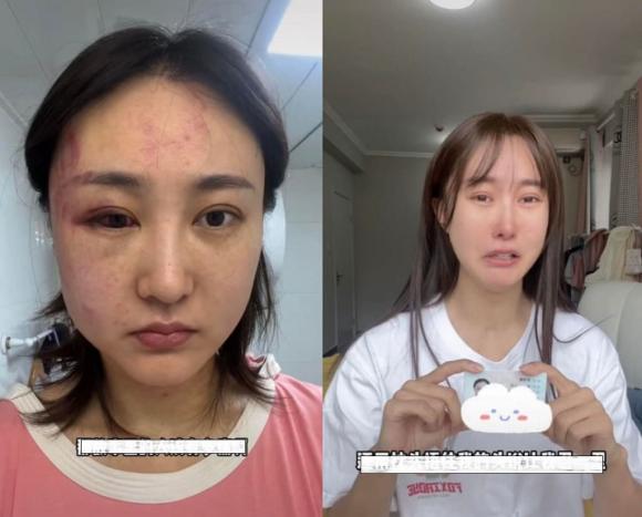  Từ Đại Bảo, sao bị bạo hành, sao hoa ngữ