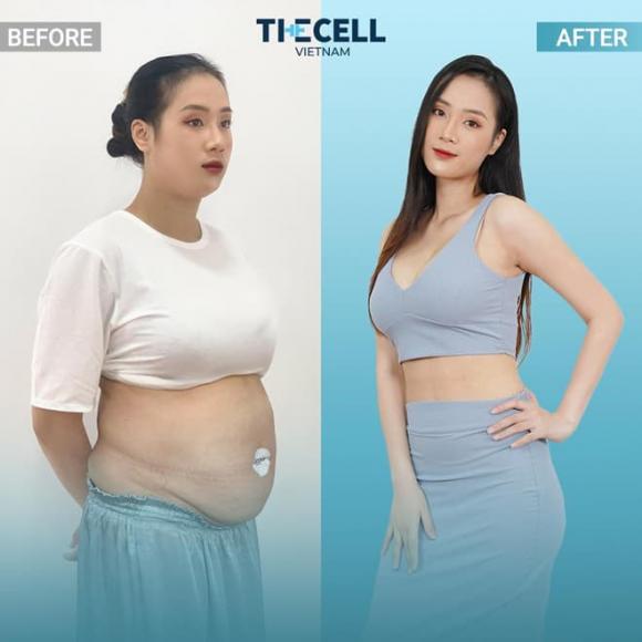 Meta Cell, giảm béo hiệu quả, giảm béo không phẫu thuật, The Cell Việt Nam