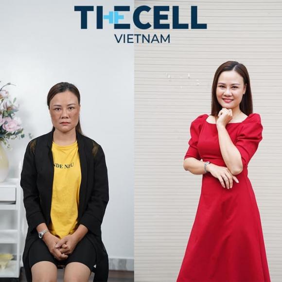 Trị nám Max Cell, nám da, The Cell Việt Nam
