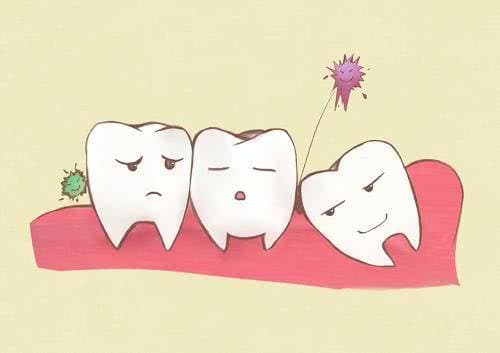 răng khôn, nhổ răng khôn, đau răng