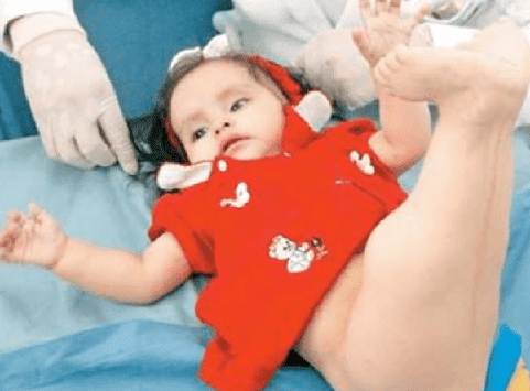 Bài học cuộc sống, hội chứng người cá, bệnh hiếm gặp