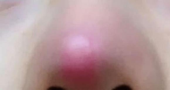 thận yếu, bệnh thận, dấu hiệu bệnh thận