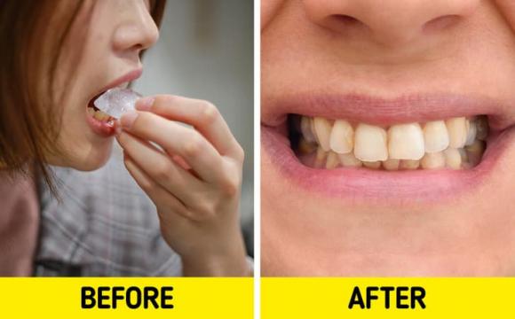 trắng răng, cách làm trắng răng, chăm sóc sức khỏe 