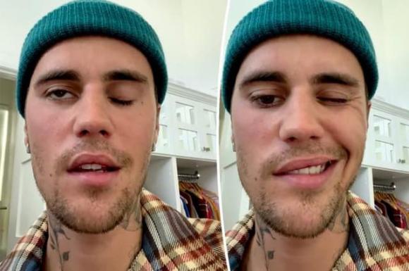 Justin Bieber, Hailey Baldwin, Justin Bieber bị bệnh, sao Hollywood