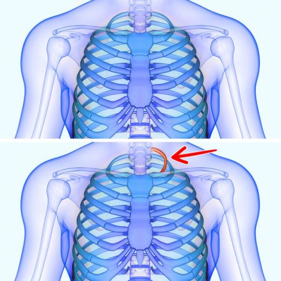 cơ thể, đặc điểm cơ thể, người đặc biệt 