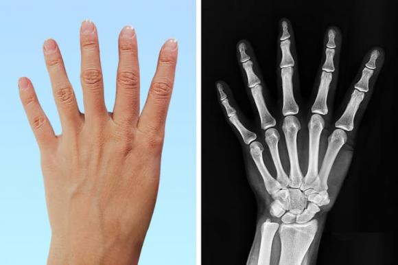 cơ thể, đặc điểm cơ thể, người đặc biệt 