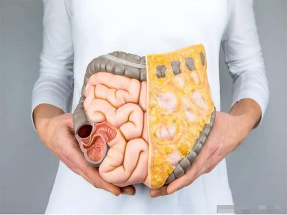  polyp, polyp ruột