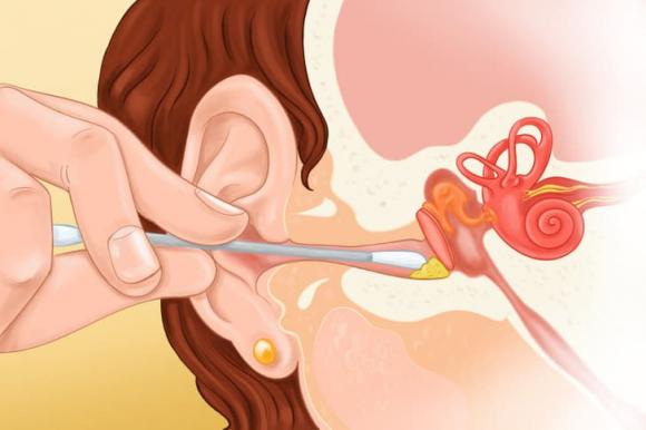 tăm bông, tăm bông ngoáy tai, sức khỏe 