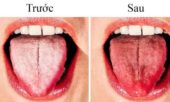 Nha khoa Ngân Phượng, tiktoker Lê Trung Hoàng, Nha khoa uy tín ở Hà Nội