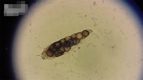 nang Demodex, ký sinh, phát hiện mới,  loài ve Demodex