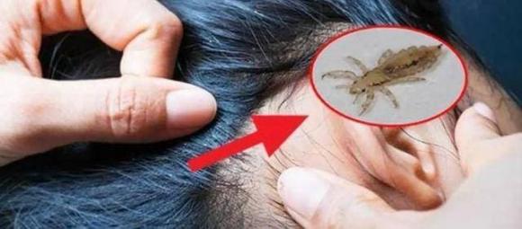 chấy, rận, sinh vật