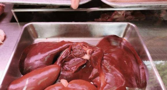 chăm sóc sức khỏe đúng cách, lưu ý khi chăm sóc sức khỏe, kí sinh trùng