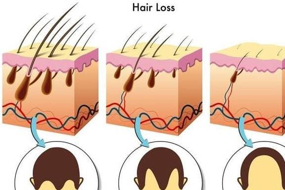  lông vùng kín,  lông vùng kín lại bị xoăn