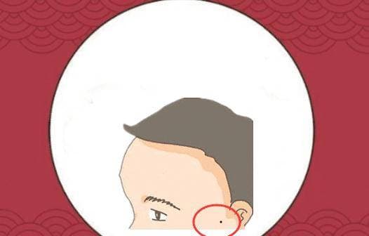 nốt ruồi, nốt ruồi xấu, tử vi, tướng số
