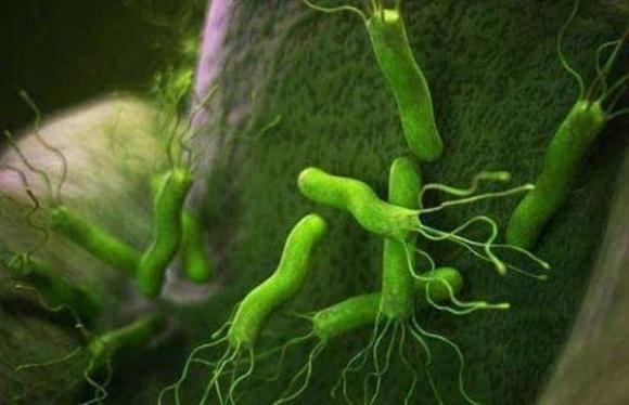 Helicobacter pylori, dạ dày, khuẩn hp