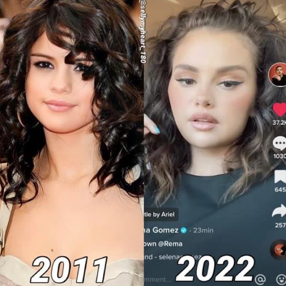So sánh ảnh hiện tại với hình cách đây hơn 10 năm của Selena Gomez mới thấy  sự thay đổi ngoạn mục