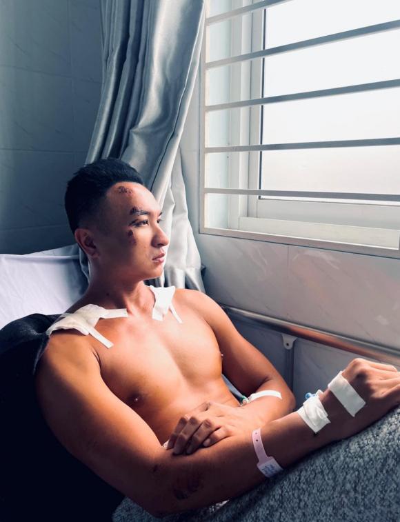 Trương Việt Phong, Trương Việt Phong bị tai nạn, sao việt 