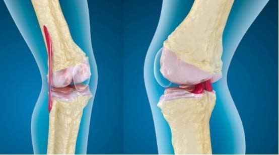 người già qua đơi sau 70 tuổi, cuộc sống của người cao tuổi, người cao tuổi