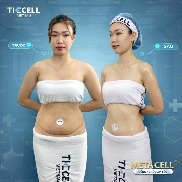 phong-kham-tham-my-the-cell (1).jpg 0 phòng khám thẩm mỹ The Cell, địa chỉ làm đẹp uy tín, spa làm đẹp