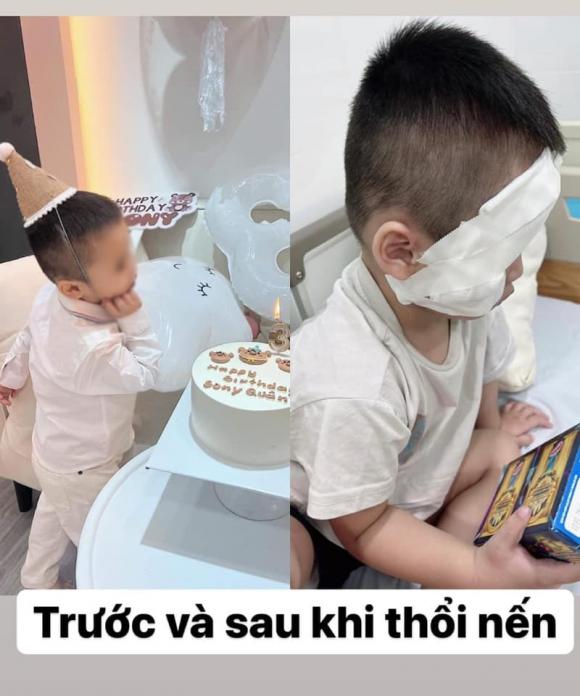 nổ bóng bay, nổ bóng bay trong sinh nhật, bị bỏng vì nổ bóng bay