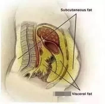 mỡ nội tạng, giảm béo, béo phì