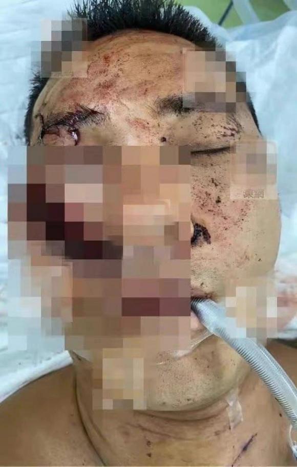Hoàng Tuấn Phong, sao TVB, sao bị tấn công