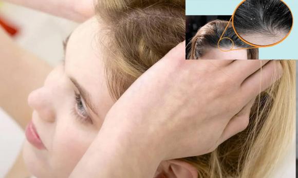 người lùn, bộ tộc người lùn, Bộ tộc 