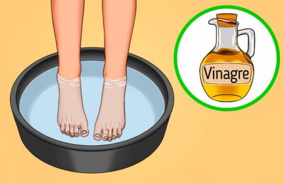 nứt gót chân, cách điều trị nứt gót chân, khỏe đẹp 