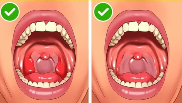 cơ thể người, bộ phận cơ thể thừa, nội tạng