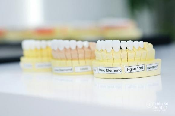 Nha khoa Thiên Sứ Dentist, Chăm sóc răng miệng, Răng sứ thẩm mỹ
