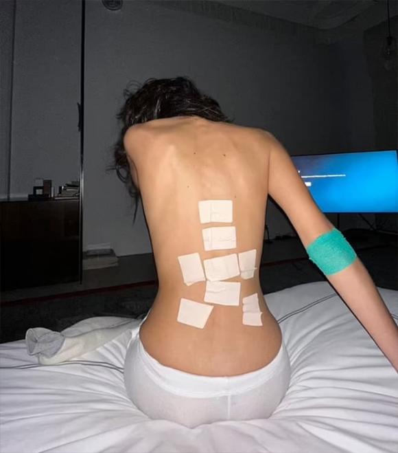 Bella Hadid, Bella Hadid chấn thương, sao Hollywood