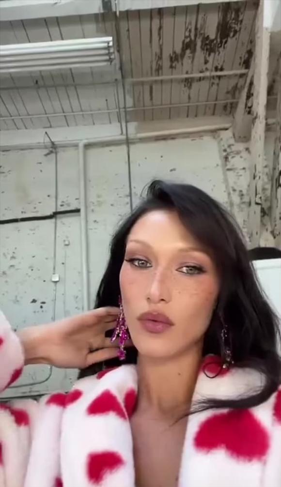 Bella Hadid, Bella Hadid chấn thương, sao Hollywood