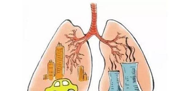 Dấu hiệu ban đầu của 'ung thư phổi', ung thư, dấu hiệu ung thư phổi