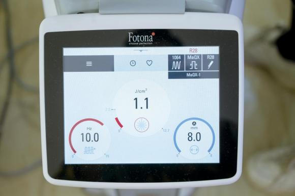 TMV EDENA, Việt Can