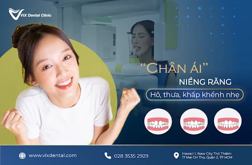 niềng răng cửa chọn lọc, Nha Khoa VIX, sức khỏe răng miệng, VIX Dental Clinic