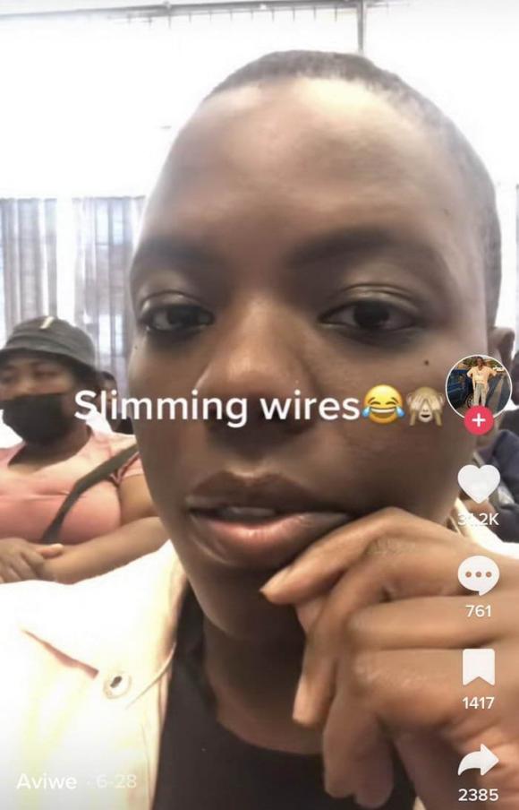 khóa răng, giảm cân, ép cân, 'Slimming Wires