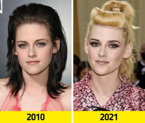 Katy Perry, Kylie Jenner, sao thay đổi diện mạo 