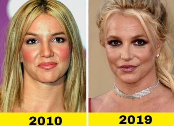 Katy Perry, Kylie Jenner, sao thay đổi diện mạo 