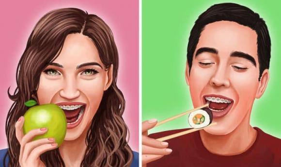 niềng răng, người niềng răng kiêng ăn gì