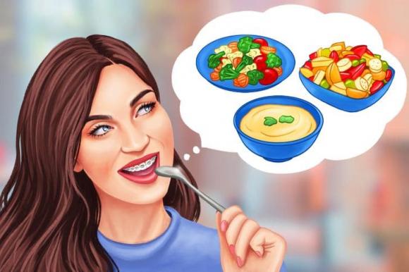 niềng răng, người niềng răng kiêng ăn gì
