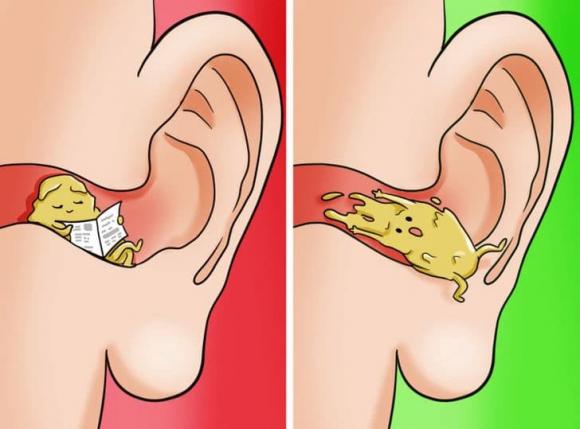 đôi tai sạch sẽ, vệ sinh tai, tai