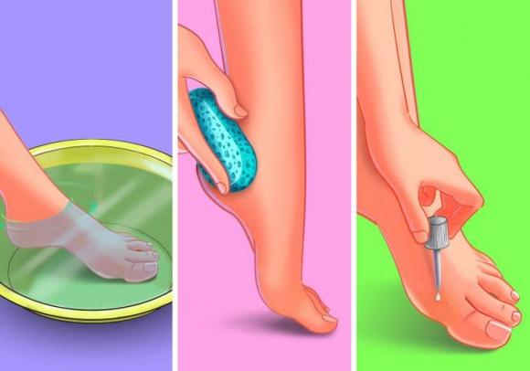 loại bỏ mụn cóc, mụn cóc, mẹo trị mụn