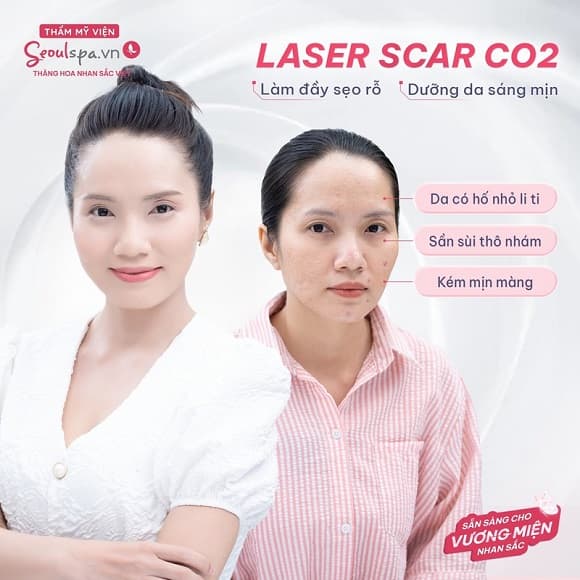 điều trị sẹo rỗ, Seoul spa
