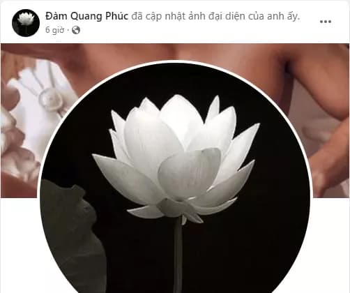 Người mẫu đàm quang phúc,đam quang phúc bị u não,sao việt