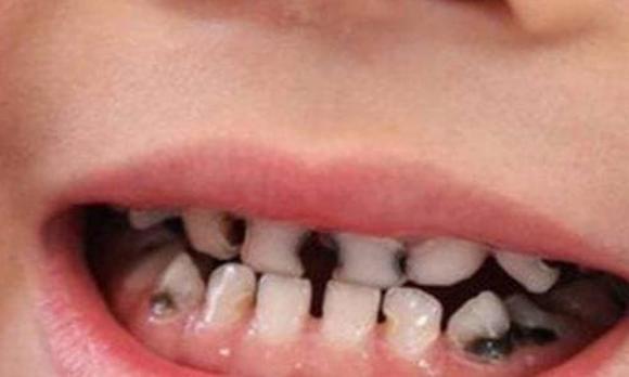 trẻ sơ sinh, lý giải trẻ sơ sinh hay cười khi ngủ, trẻ nằm mơ