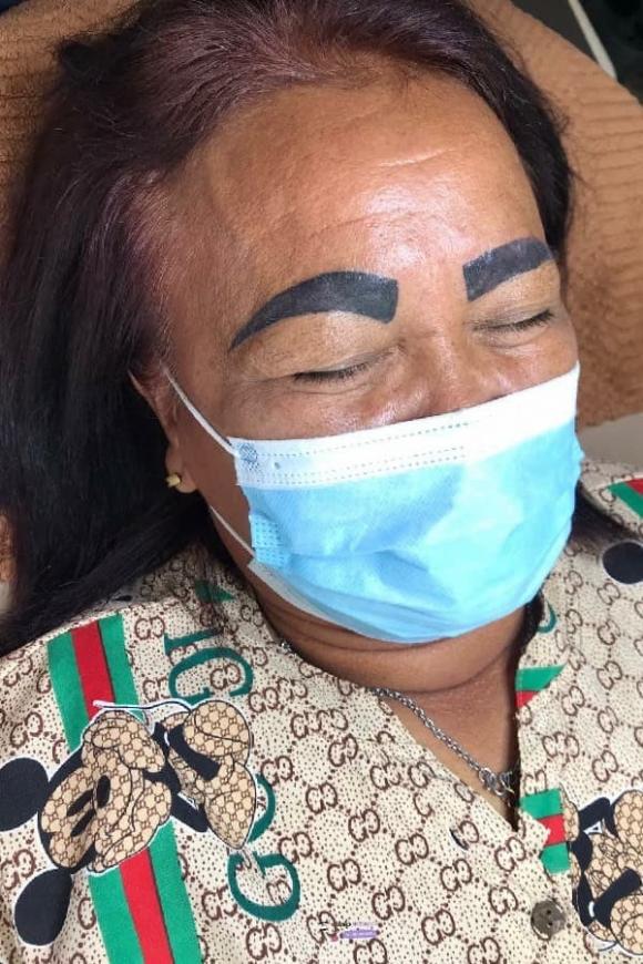 xăm lông mày, xăm lông mày hỏng, làm đẹp lông mày