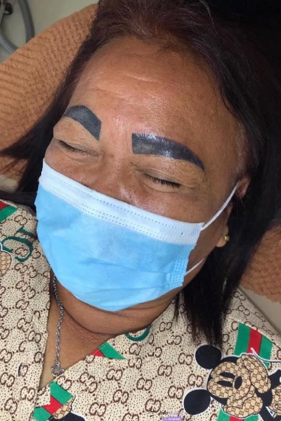 xăm lông mày, xăm lông mày hỏng, làm đẹp lông mày