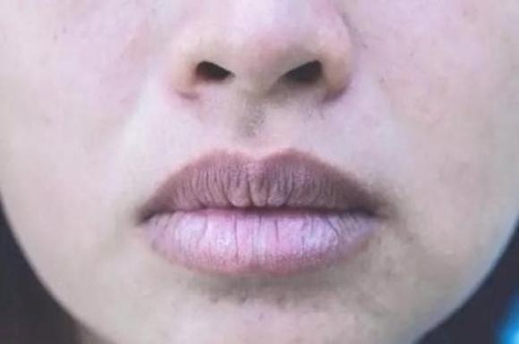 đoản thọ, thọ thấp, sức khoẻ